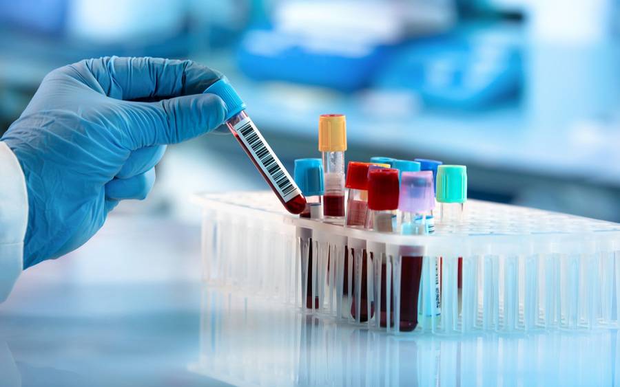 blood sample collection at home in Hyderabad