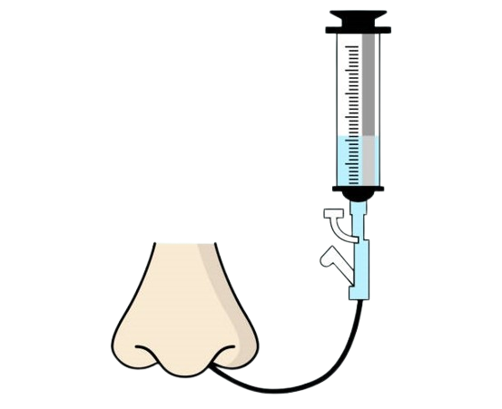 Ryle's Tube